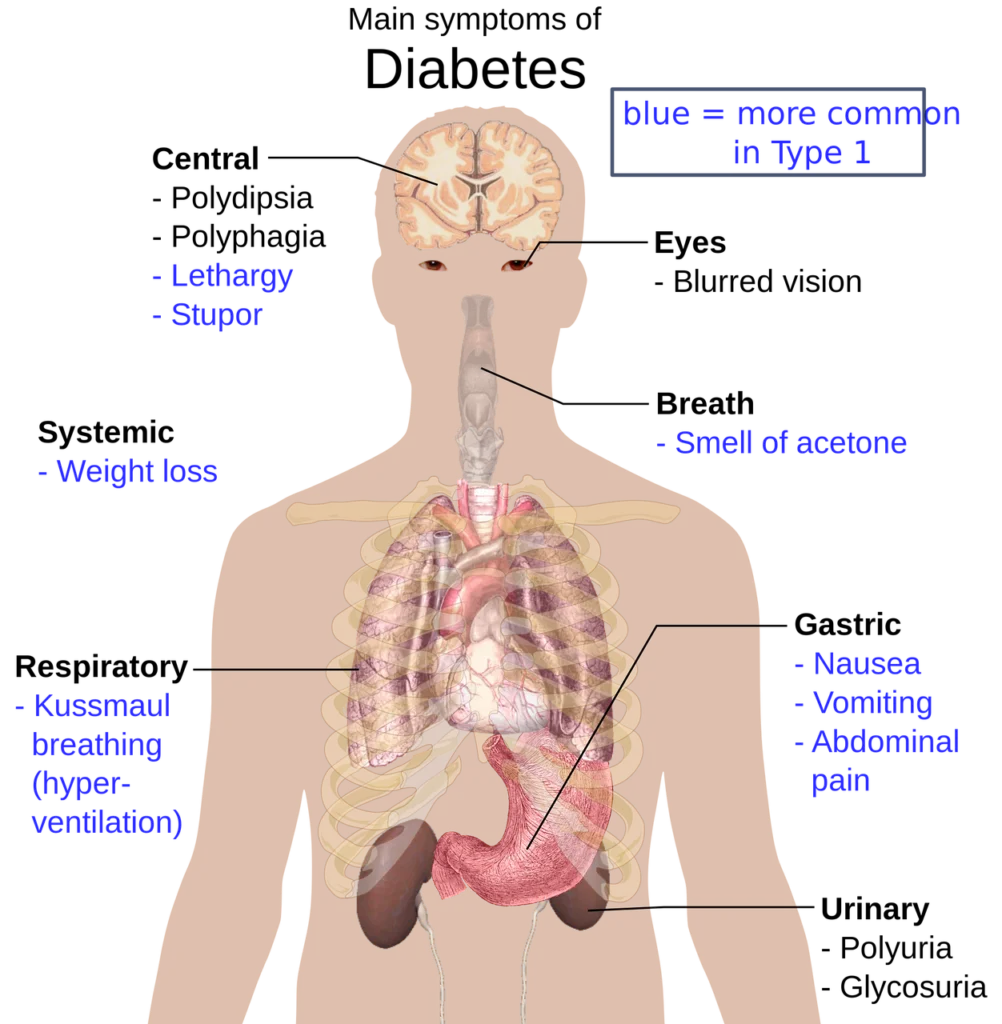 Why is Better Stay safe while flying with diabetes: natural healing clinic